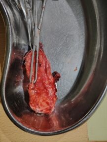 IMG_20250609_151817 IMG_20250609_151817