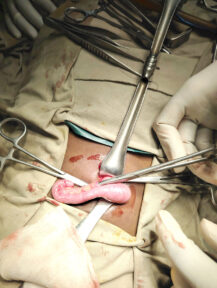 Pediatric-Surgery-2 Pediatric-Surgery-2