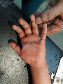 Pediatric-surgery-case3-01 Pediatric-surgery-case3-01