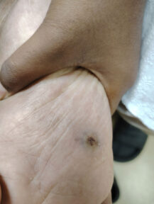 Pediatric-surgery-case5-01 Pediatric-surgery-case5-01